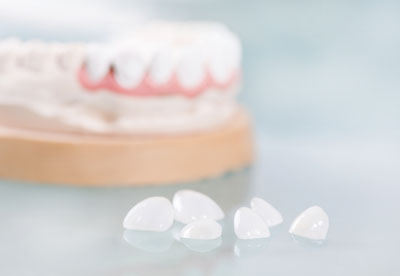 Dental Crowns That Keep Your Teeth And Gums From Graying