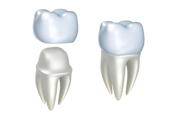 Mini Dental Implants LaGrange, GA