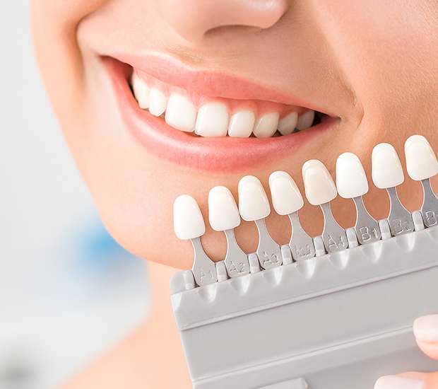 LaGrange Dental Veneers and Dental Laminates