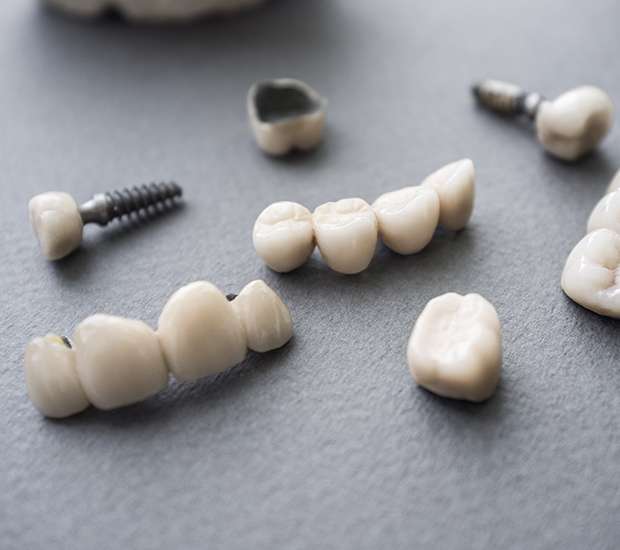 LaGrange The Difference Between Dental Implants and Mini Dental Implants